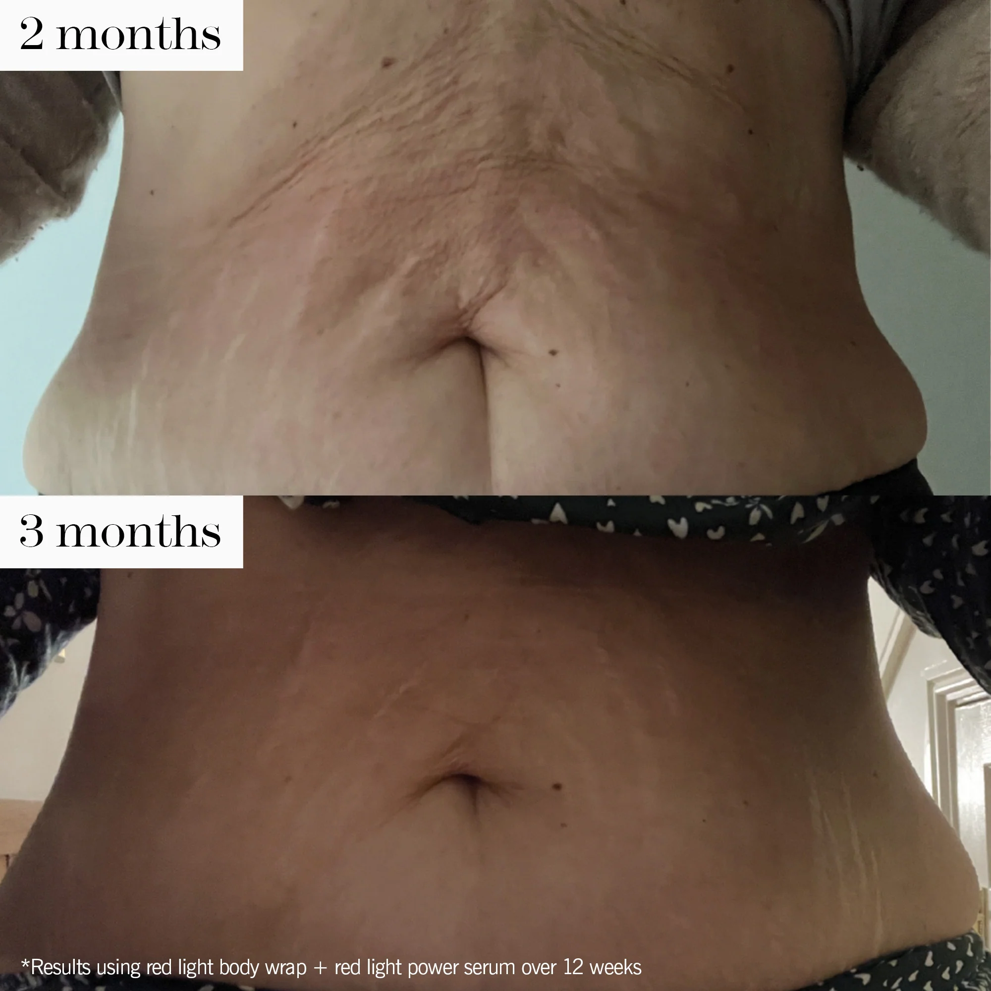 advanced red light system - Image 4