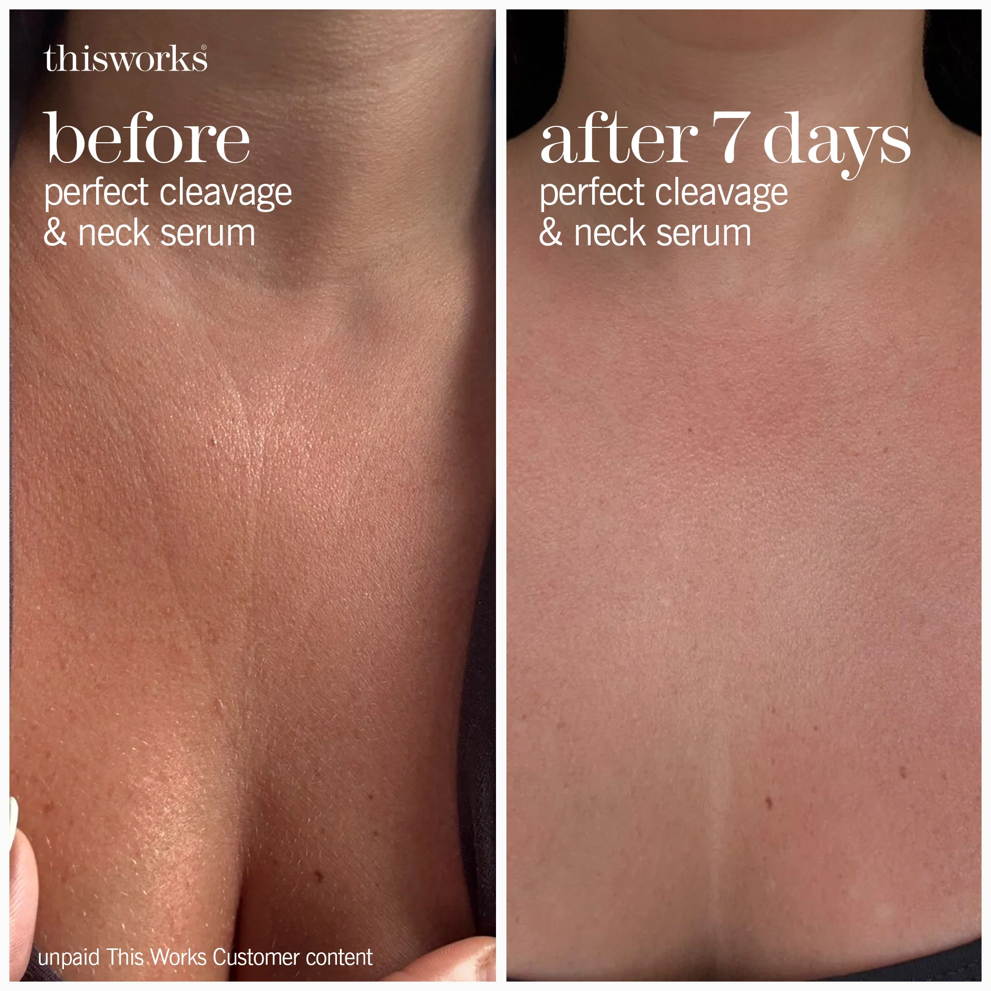 perfect cleavage & neck serum - Image 4