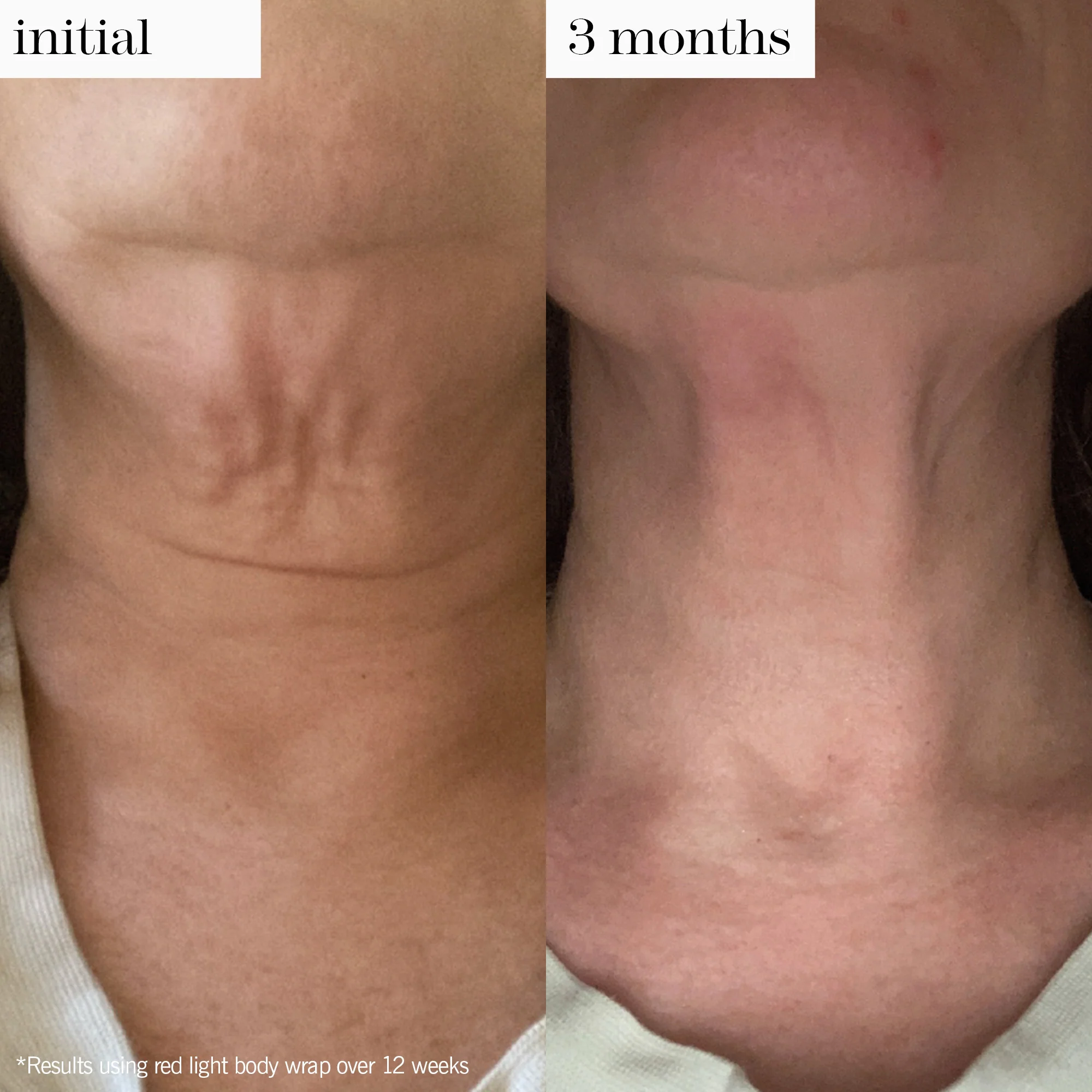 red light body wrap duo - Image 5